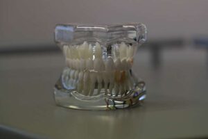  zobna proteza